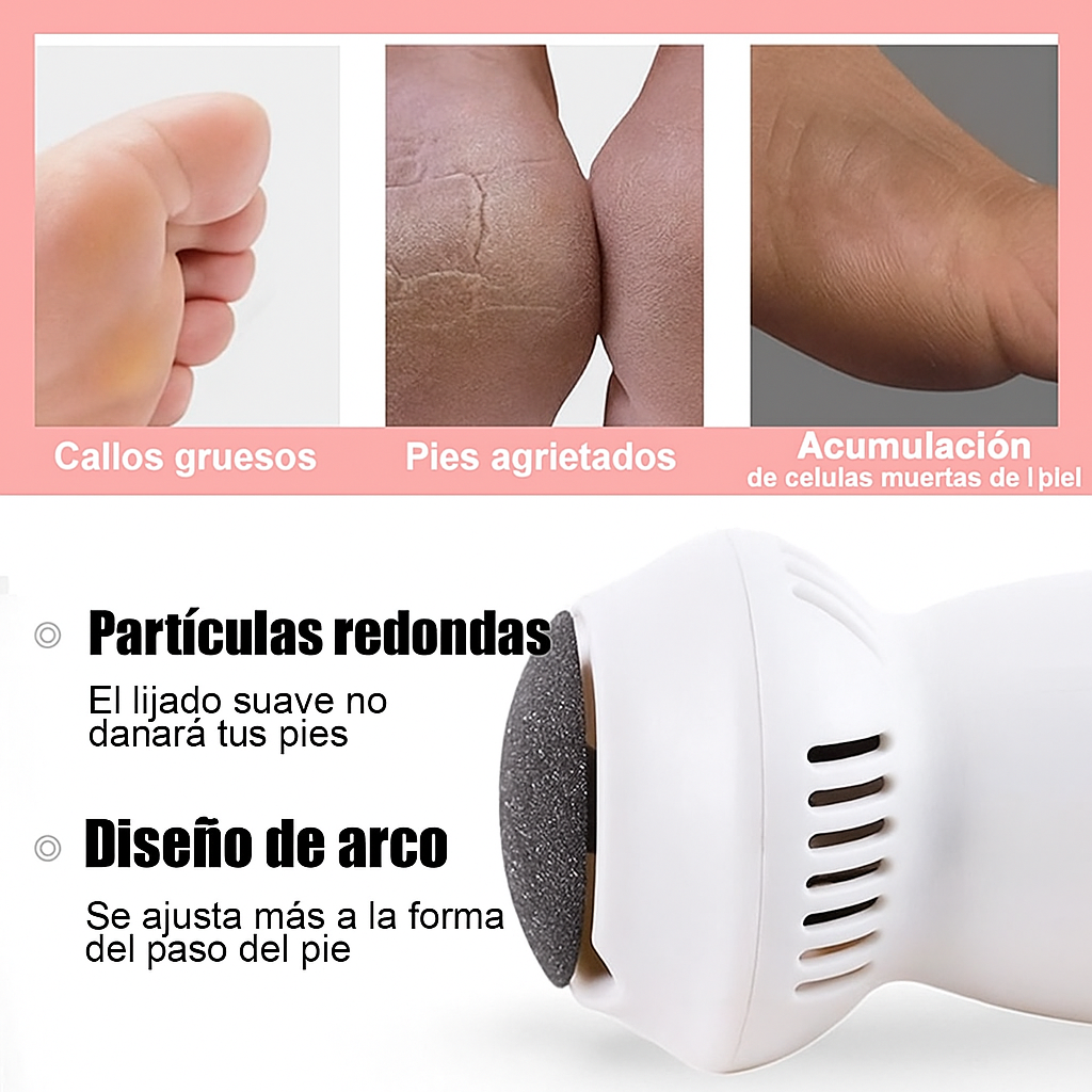 Elimina callos al instante sin salir de casa — Pies suaves en minutos